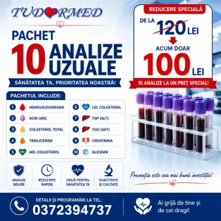 Pachet 10 analize uzuale la 100 lei — TUDORMED