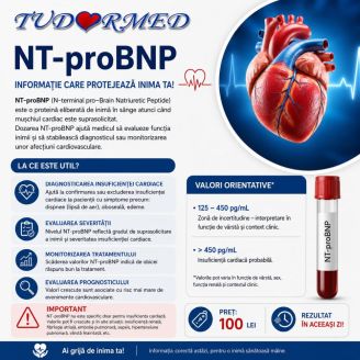 Analiza NT-proBNP